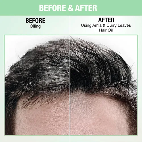 Vista 3 de Nykaa Naturals Aceite para el cabello - Amla y curry para mujeres - 6.76 oz Aceite