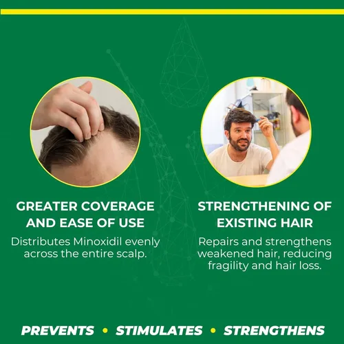 Vista 5 de Crecepelo Minoxidil Solución para el crecimiento del cabello, solución tópica al 5% con extractos naturales, 3.2 fl oz - NDC: 78192-400