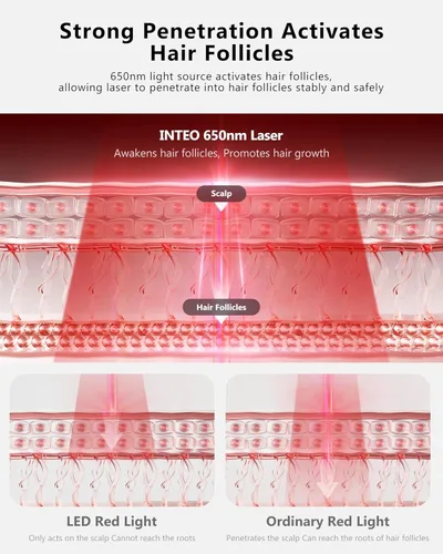 Vista 2 de Terapia de luz roja para el crecimiento del cabello, gorra de crecimiento láser para pérdida de cabello, batería recargable, crecimiento del cabello