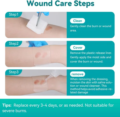 Vista 7 de Dimora Apósito de Hidrogel para Heridas de 1.7" x 3" - Almohadillas para Quemaduras Vendaje Estéril Calmante, Tratamiento Protector Refrescante