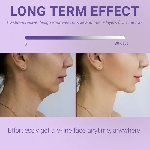 Vista 2 de Correa para la barbilla para dormir, reductor de doble barbilla, ajuste cómodo ajustable, 100% hipoalergénica, resistente, cinta de levantamiento