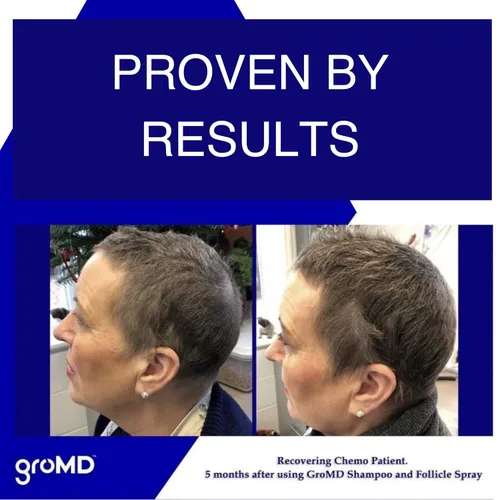 Vista 2 de GroMD Champú y acondicionador de biotina, champú para el crecimiento del cabello, champú para la pérdida de cabello para hombres y mujeres