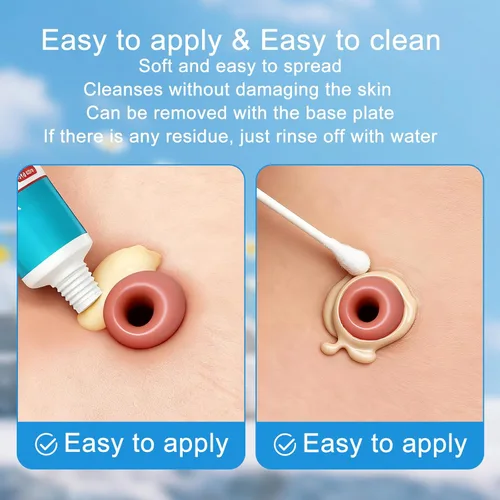 Vista 4 de Pasta de barrera para ostomía, tubo de 2 onzas para prevención de fugas, pasta de llenado de estoma sin alcohol que crea un sello protector