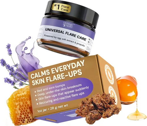 MyMagicHealer Universal Flare Care | Pomada Extractora para HS, forúnculos, quistes, hemorroides, quiste pilonidal, absceso | Anti-rozaduras,