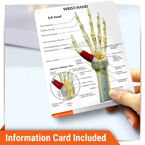 Vista 4 de GPI Anatomicals - Modelo de mano y muñeca, réplica de mano y muñeca con síndrome del túnel carpiano para la educación en anatomía y fisiología