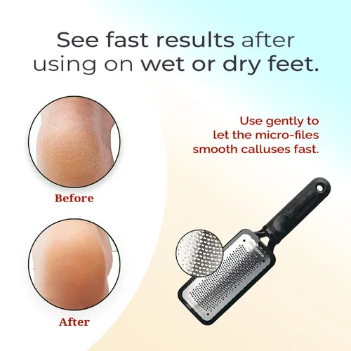 Vista 5 de Escofina para pedicura Microplane, tamaño gigante, Negro