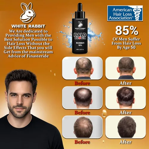 Vista 3 de Bald Block - 10% RU58841 - Por White Rabbit - Suero de pérdida de cabello para hombres y mujeres - Potente bloqueador de DHT - Máxima resistencia