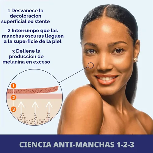 Vista 5 de Palmer's Skin Success - Loción corporal antimanchas antimanchas de leche, 8.5 onzas