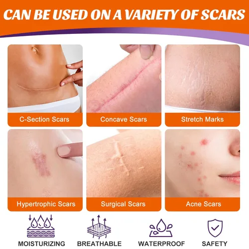 Vista 4 de Cinta de silicona para cicatrices (rollo de 158 x 1.6 pulgadas, 13.1 ft), hojas de silicona para cicatrices quirúrgicas, tiras de silicona