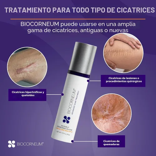Vista 4 de Supervisión avanzada de cicatrices con FPS 30 bioCorneum (tamaño: 10 g) Advanced Scar Treatment with Silishield®, Water Resistant Silicone Gel for