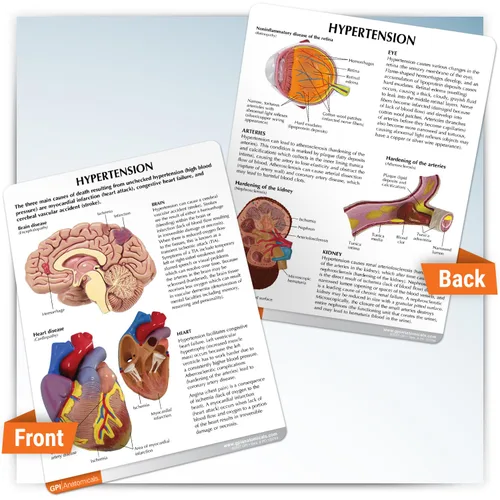 Vista 4 de GPI Anatomicals - Set de modelo de hipertensión, réplica para educación de anatomía y fisiología humana, modelo anatómico para consultorios médicos