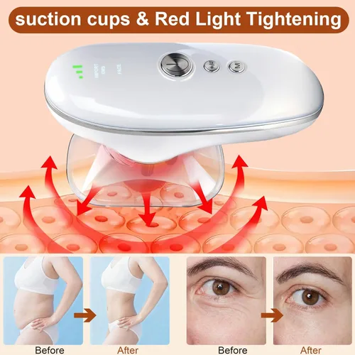 Vista 4 de 5-in-1 Electric Body Sculpting Massager - Red Blue LED Light Therapy & Microcurrent Tool with Oval/Round Suction Cups for Face & Body Tightening