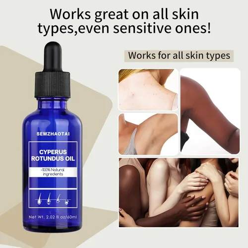 Vista 4 de Aceite Cyperus Rotundus – Aceite natural de hierba de nuez para depilación, reduce el crecimiento del vello corporal, piel suave e hidratante