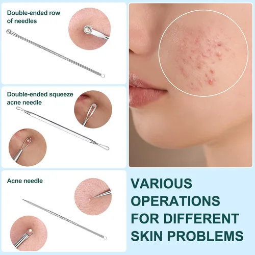 Vista 6 de Extractor de puntos negros, 3 piezas, herramienta para reventar espinillas, herramienta extractora de comedones para acné y manchas de espinillas