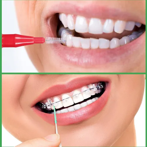 Vista 4 de Patelai 350 piezas de cepillo interdental hilo dental herramienta de limpieza de dientes palillo de dientes cabeza de hilo dental Flosser oral