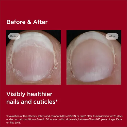 Vista 6 de ISDIN SI-NAILS - Tratamiento de suero para cutículas fortalecedor de uñas con ácido hialurónico, 0.08 onzas líquidas (paquete de 1)