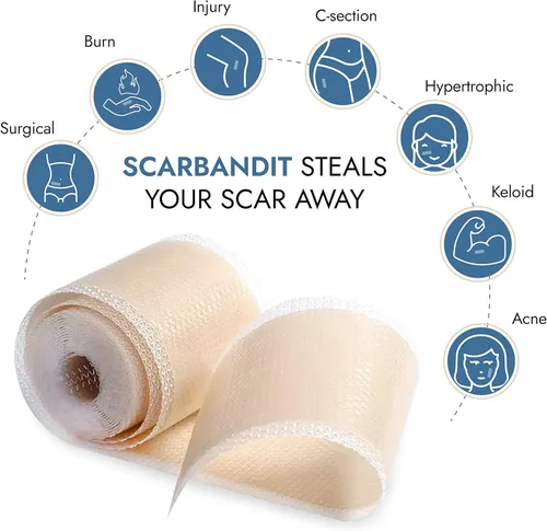 Vista 3 de Scarbandit Cinta de silicona para cicatrices – Hojas de cicatrices para eliminación de protuberancias queloides, abdominoplastia, cesárea