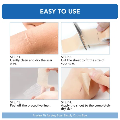 Vista 4 de Hojas de silicona para cicatrices, cinta adhesiva de silicona (rollo de 1.6 x 60 pulgadas - 4.9 ft), cinta adhesiva reutilizable, suave y de grado