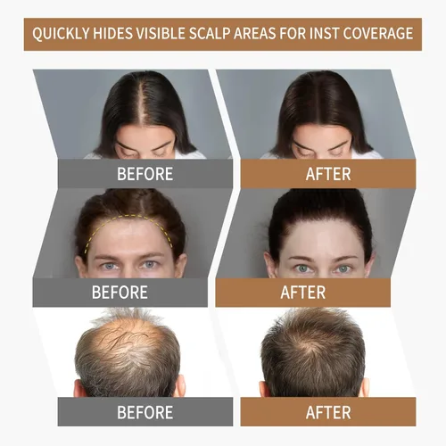 Vista 2 de Polvo para Línea de Cabello Sevich 2.0, Oculta Instantáneamente la Pérdida de Cabello, Polvo para Toque de Raíces, Sombra de Cabello para Mujeres