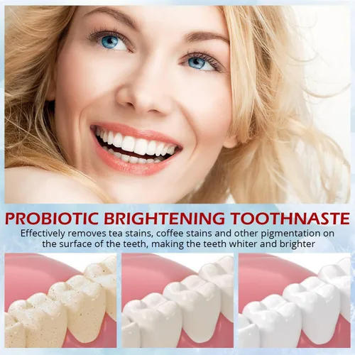 Vista 6 de Pasta dental blanqueadora con probióticos SP-6 - Probióticos para blanquear dientes y salud de las encías - Segura para el esmalte, sin flúor, sabor