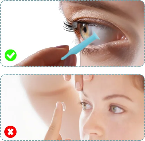Vista 3 de 30 piezas de herramienta de eliminación de lentes de contacto, herramienta de contacto ocular removedor e insertador para contactos suaves, lentes