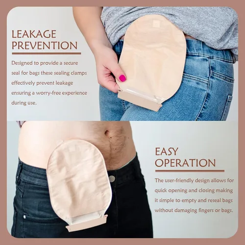 Vista 5 de 15 clips para bolsas de ostomía – Abrazaderas de bolsa drenables a prueba de fugas para cuidado de colostomía/ileostomía, barras de sellado