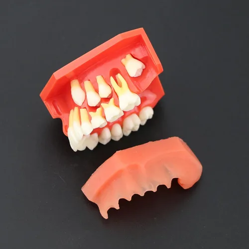 Vista 8 de Modelo de dientes dentales Typodont Desarrollo pediátrico 9-12 años Dientes Constantes crecen Reemplazar Demostración Anatomía Enseñanza Estudio