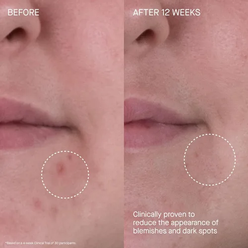 Vista 5 de Augustinus Bader The Rich Cream – Luxury Face Cream – Hydrating and Nourishing Face Moisturizer – Facial Moisturizer for Wrinkle Reduction and