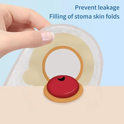 Vista 5 de Pasta de ostomía, barrera cutánea sin alcohol para relleno de estoma para evitar fugas, suministros para el cuidado del estoma (2 cajas)
