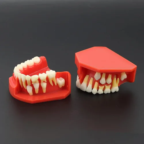 Vista 6 de Modelo de dientes dentales Typodont Desarrollo pediátrico 9-12 años Dientes Constantes crecen Reemplazar Demostración Anatomía Enseñanza Estudio