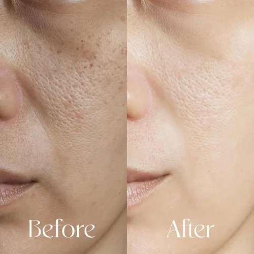 Vista 5 de Aceite de cúrcuma, agente nutritivo, removedor de maquillaje orgánico, aclarando la piel, resplandor radiante