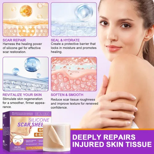 Vista 3 de Hojas de silicona para cicatrices, cinta de silicona para cicatrices (1.6 x 60 pulgadas), cinta de cicatriz de grado médico para cicatrices