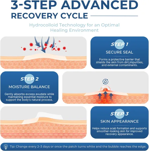 Vista 2 de Rollo hidrocoloide de grado médico de 2 pulgadas x 20 pies – Cinta hidrocoloide autoadhesiva impermeable extra larga para el cuidado de heridas