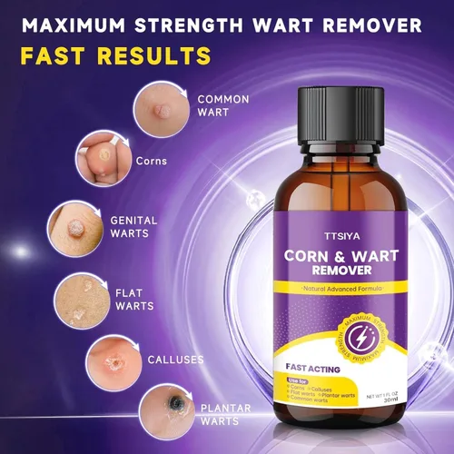 Vista 2 de Wart Remover 17% Salicylic Acid, Fast-Acting Treatment for Plantar, Common, Flat Warts, Corn & Callus Remover Liquid, 30 ML
