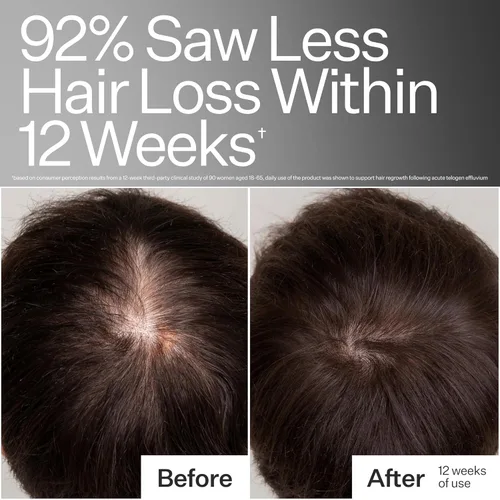 Vista 5 de Act+Acre - Tratamiento de péptidos de células madre procesadas en frío al 3 %, aumenta la densidad del cabello, células madre de uva, péptidos +