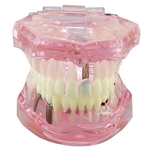 Vista 8 de Multifarious Tipos Modelo Dental Dientes Removibles Implante Ortodoncia Enseñanza Estudiar Modelos de demostración para Dentista Estudiante Escuela
