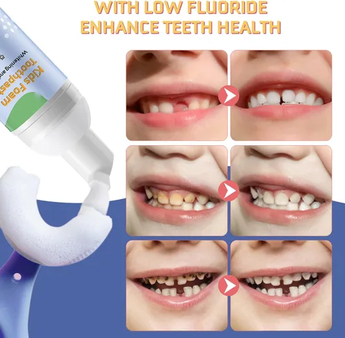 Vista 2 de Pasta de dientes de espuma para niños, 2 unidades, pasta de dientes para niños pequeños, protección de caries, limpia y blanqueadora, cuidado