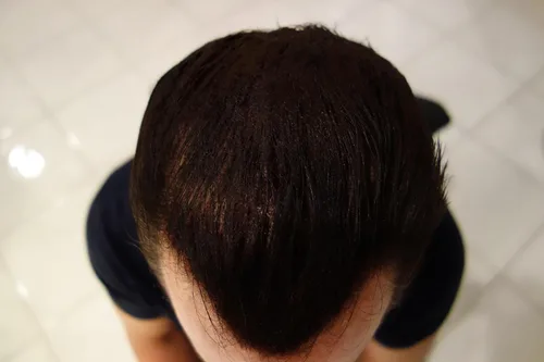 Vista 5 de Edificio de pelo fibras 100 gramos Refill su botella existente. Grado más alto por por último Hair