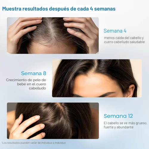 Vista 6 de Be Bodywise Rollo de suero para el crecimiento del cabello de romero de 1.7 fl oz - 3% de romero, 3% de redensilo y 2% de nuevo El suero
