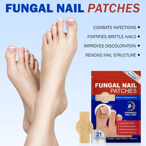 Vista 2 de Parches de uñas para reparación de uñas de los pies – 42 piezas de soporte de uñas durante la noche para uñas dañadas, gruesas o amarillas, fórmula