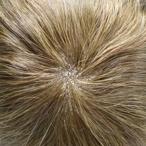 Vista 439 de Toupee - Sistemas de reemplazo de cabello para hombre, encaje frontal suizo, nudo blanqueado, pieza de cabello humano natural