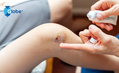 Vista 5 de Globe Paquete de 3 ungüentos antibióticos triples de 1 oz, ungüento de primeros auxilios para pequeños arañazos y heridas y previene infecciones