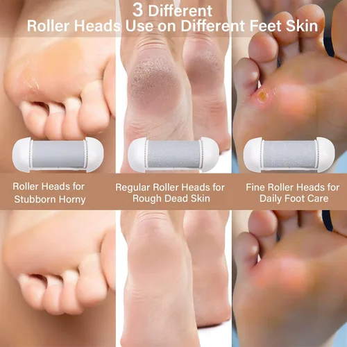Vista 4 de Removedor eléctrico de callos para pies, lima de pies recargable con 3 cabezales de rodillo, 2 velocidades, pantalla de batería + 10 herramientas