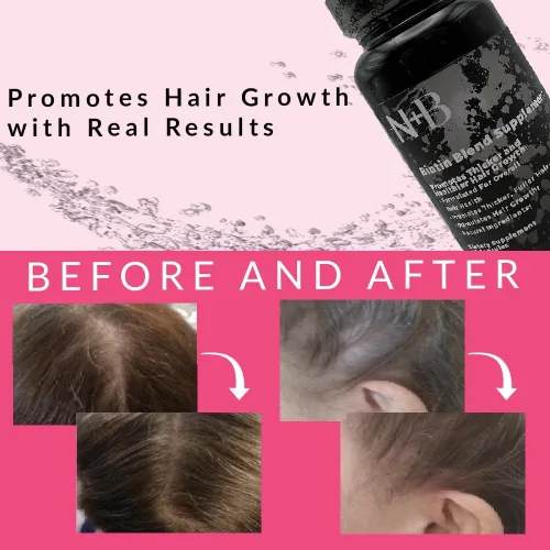 Vista 5 de Nicole + Brizee N+B Vitaminas para el crecimiento del cabello, con biotina, vitamina C, zinc y vitamina B12, fórmula para el cuidado del cabello a