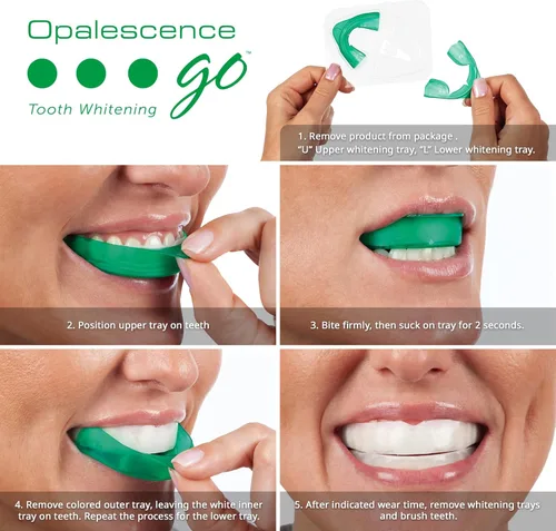 Vista 2 de Opalescence GO 15% (10 tratamientos) Bandejas blanqueadoras de dientes originales precargadas con pasta de dientes blanqueadora de viaje, 1.0 onzas
