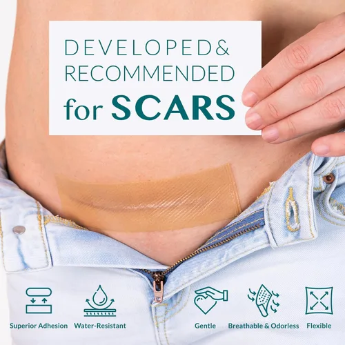 Vista 4 de Cinta de silicona para cicatrices, hojas de cicatriz de silicona, cinta de cicatriz para cicatrices quirúrgicas, cinta de silicona para cicatrices