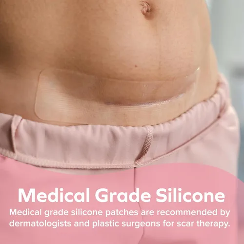 Vista 5 de Dr. Talbot's Mom - Tiras de cicatrices de silicona de grado médico para suavizar y aplanar cicatrices quirúrgicas, 6