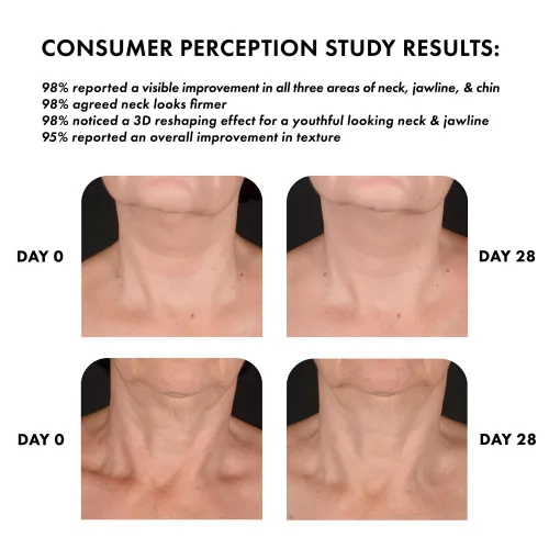Vista 2 de Whish Crema reafirmante para el cuello con Bakuchiol - Efecto de remodelación 3D para cuello, mandíbula y barbilla - 3.4 oz