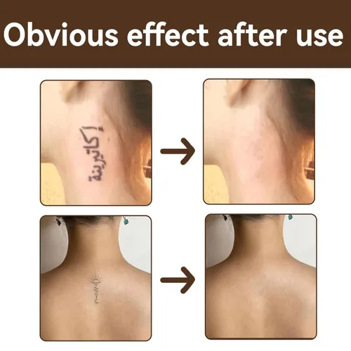 Vista 2 de Cubierta de tatuaje, corrector invisible impermeable para el cuerpo, piernas, contusión, cicatriz, manchas oscuras, vitíligo, maquillaje de piel