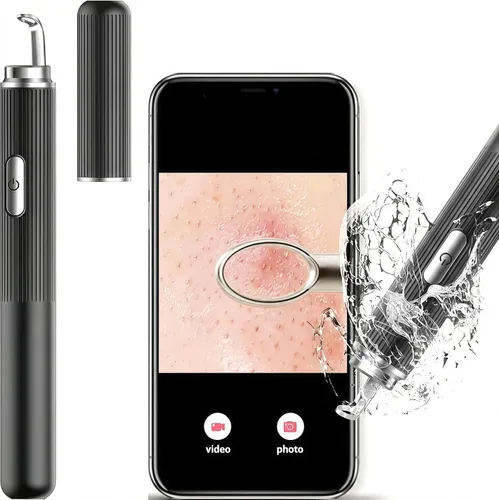 Vista 9 de Removedor de puntos negros con cámara, WiFi Visual Blackhead Remover Herramientas con luces blancas/azules para iPhone, teléfonos Android, regalo